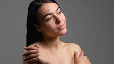 La magia del cuidado de la piel: Buscando la armonía en pieles sensibles