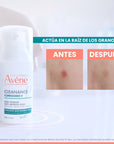 Avène Cleanance Comedomed Concentrado Anti-Imperfecciones 30ml.