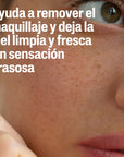 Cetaphil Desmaquillante Oil Free Bifásico 177ml.