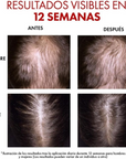 Vichy Dercos Regen Serum Fortalecedor Capilar Anticaída 90ml.