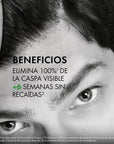 Vichy Dercos Shampoo Anticaspa Cabello Seco 200ml.