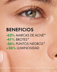 Vichy Normaderm Phytosolution Gel Hidratante Antiimperfecciones 50ml.