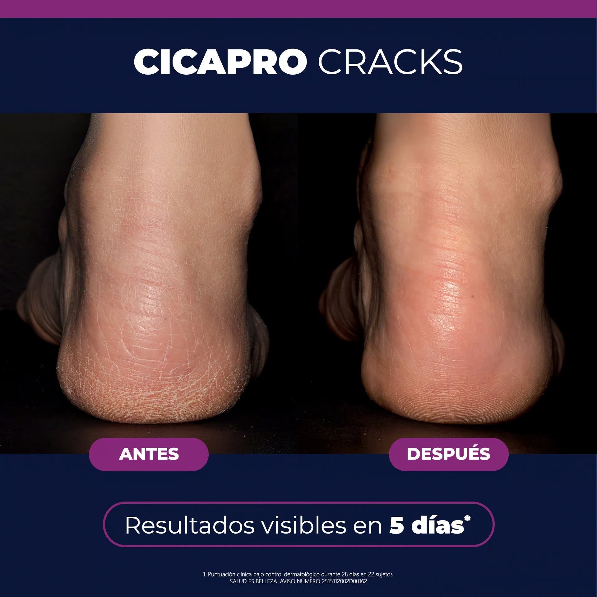Isispharma Cicapro Cracks Bálsamo Reparador 40ml.