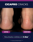 Isispharma Cicapro Cracks Bálsamo Reparador 40ml.