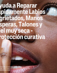 Cetaphil Bálsamo Multireparador 50 g