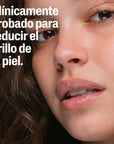Cetaphil PRO AC Dermacontrol Loción Facial Hidratante con FPS 30 118ml.