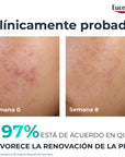 Eucerin DermoPure Clinical Peeling Renovador Anti-Imperfecciones 40ml.