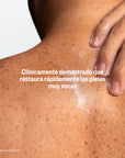 Cetaphil PRO AD Restoraderm Hidratante Corporal con Ceramidas para Piel Atópica 236ml.