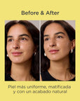 Isdin Acniben CC+ Cream Medium SPF30 40 ml