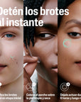 Cetaphil Parches Anti-Imperfecciones Piel Limpia y Protegida 24pz.