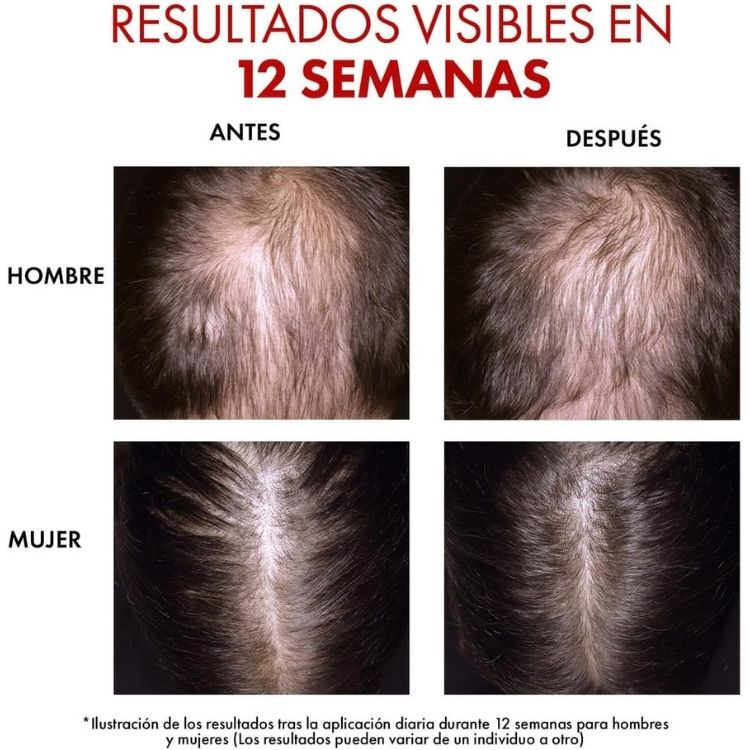 Vichy Dercos Regen Serum Fortalecedor Capilar Anticaída 90ml.
