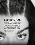 Vichy Dercos Shampoo Anticaspa Cabello Graso 200ml.